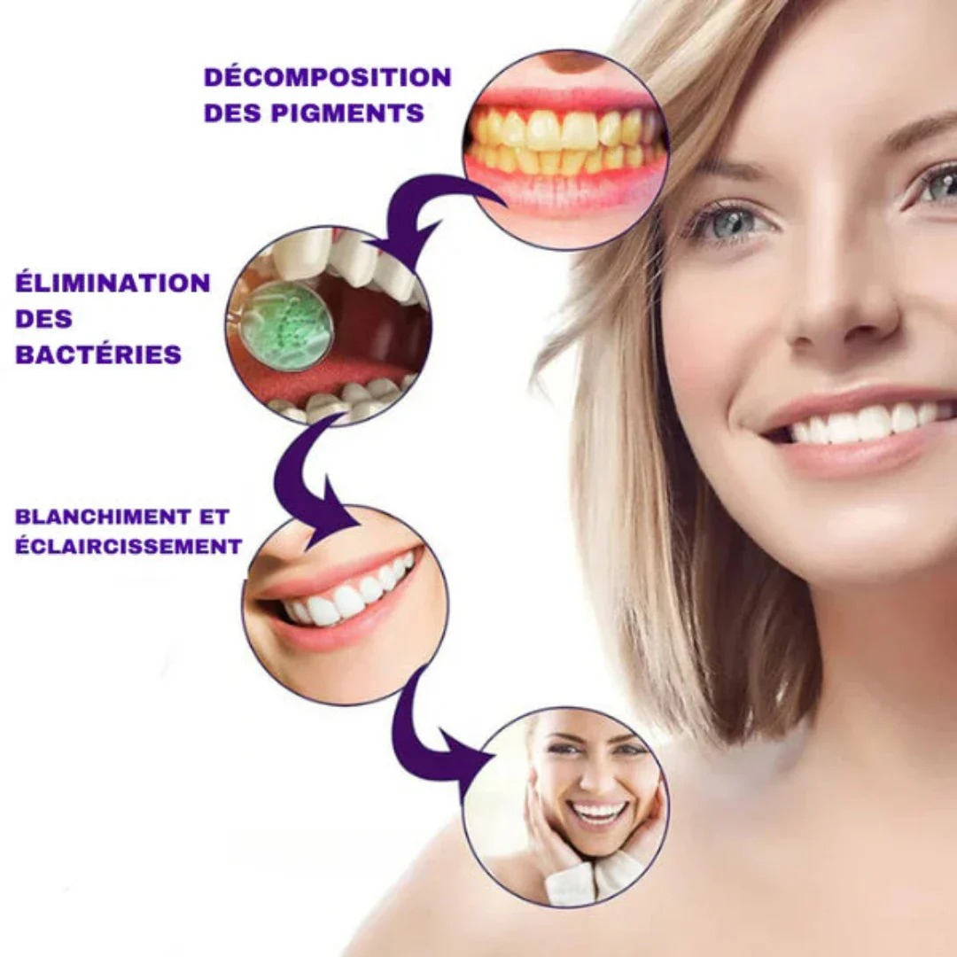 BLANQUEADOR Dental - SmileEase