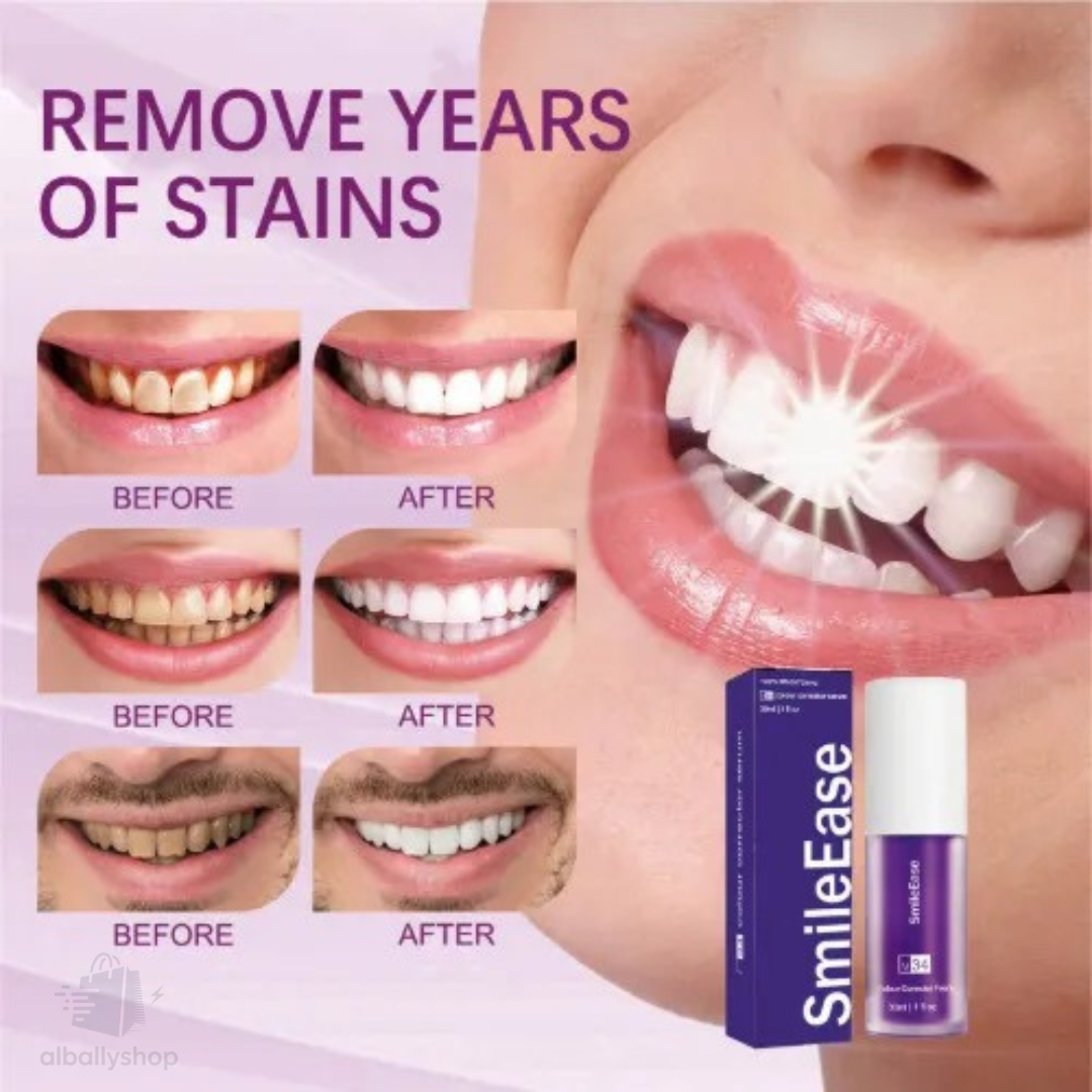 BLANQUEADOR Dental - SmileEase
